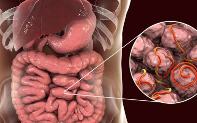 La Maladie de Crohn Intestin Grêle : Comprendre cette Maladie Chronique
