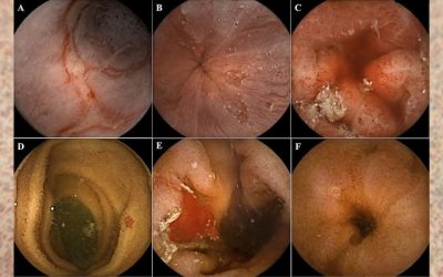 La vidéo-capsule : révolutionner vos examens médicaux