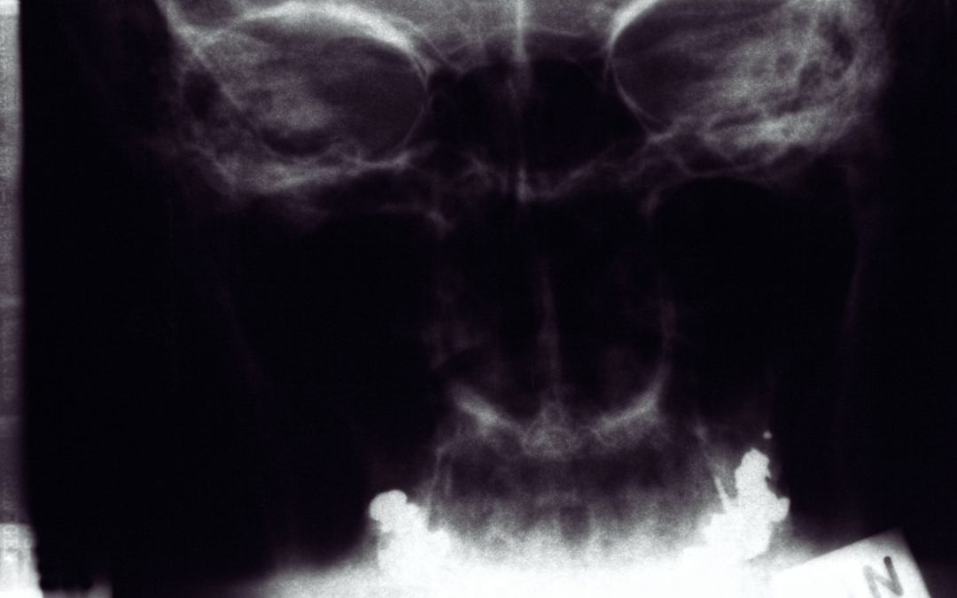 maladie de Crohn diagnostic : comment identifier et confirmer la maladie ?