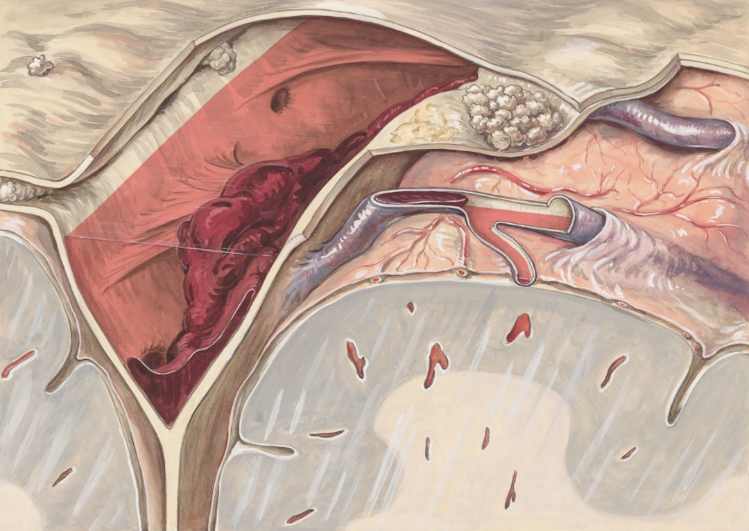 Qu'est-ce qu'un ulcère gastrique et du duodénum : définition et localisation de la douleur